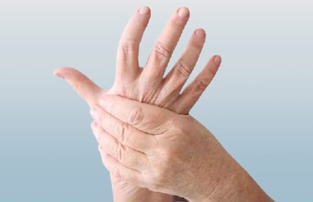 Casos-de-artritis-reumatoide-aumentaron-en-el-mundo-en-los-ultimos-30-anos